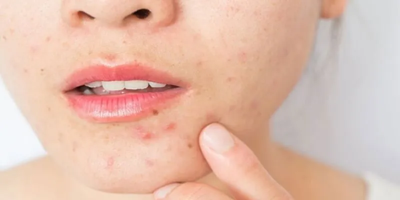 Da mặt bị nhiễm chì
