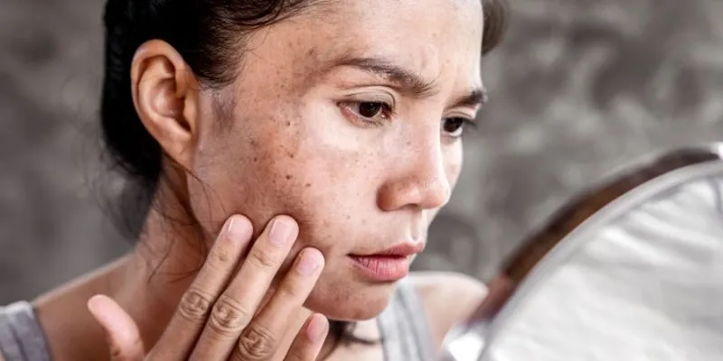 Da mặt bị nhiễm chì